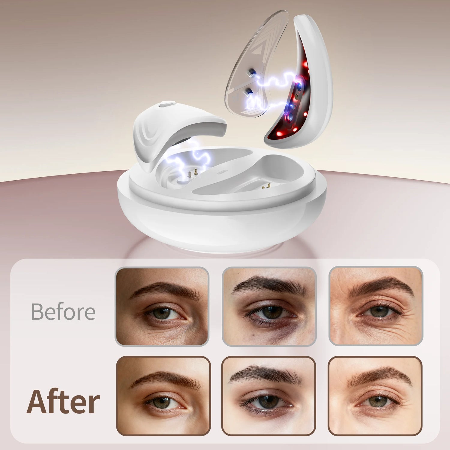 EMS Red-Light Eye Reviver
